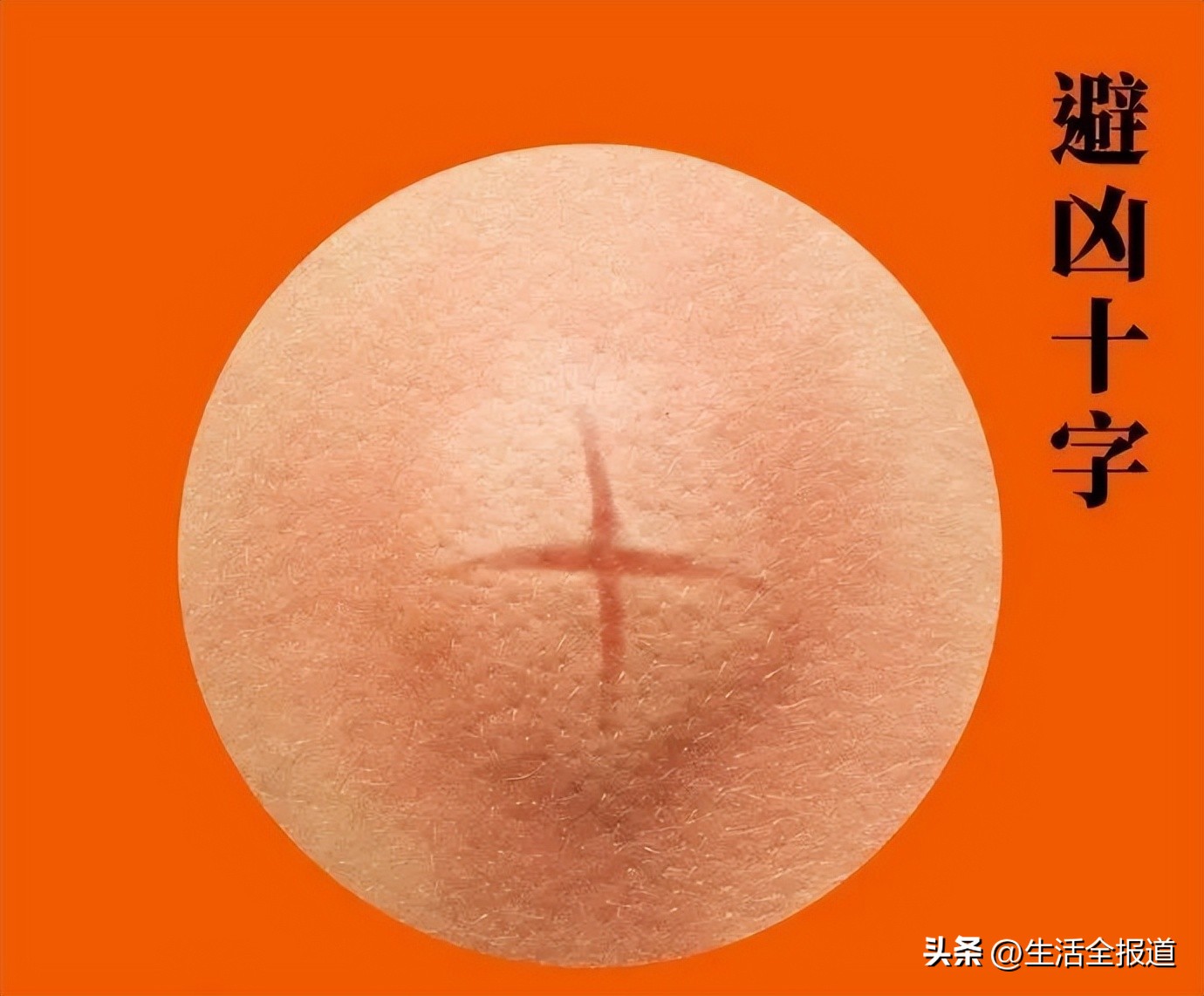 蚊子包止痒妙招,怎么给蚊子包止痒