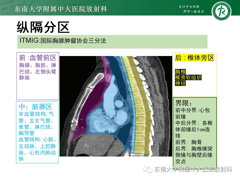 好文分享值得深思,纵隔精原细胞瘤