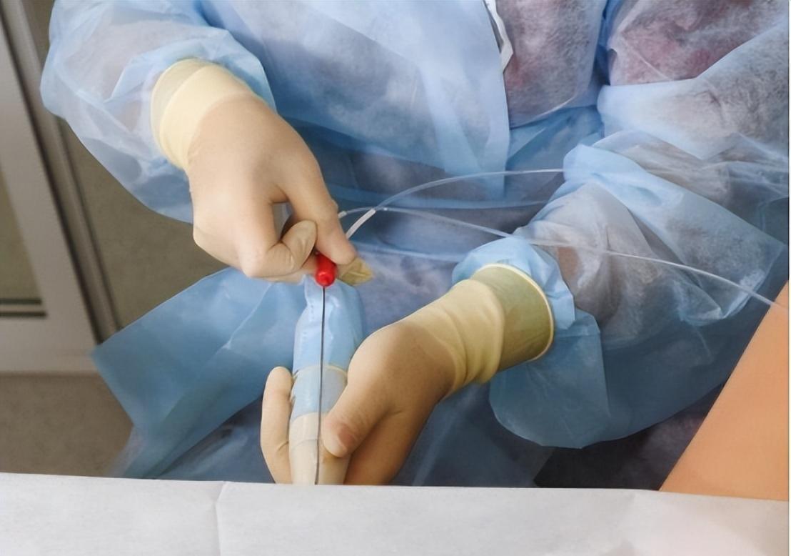 “五万一次，刺穿*体下**”？比*交性**易更可怕的是无*交性**易