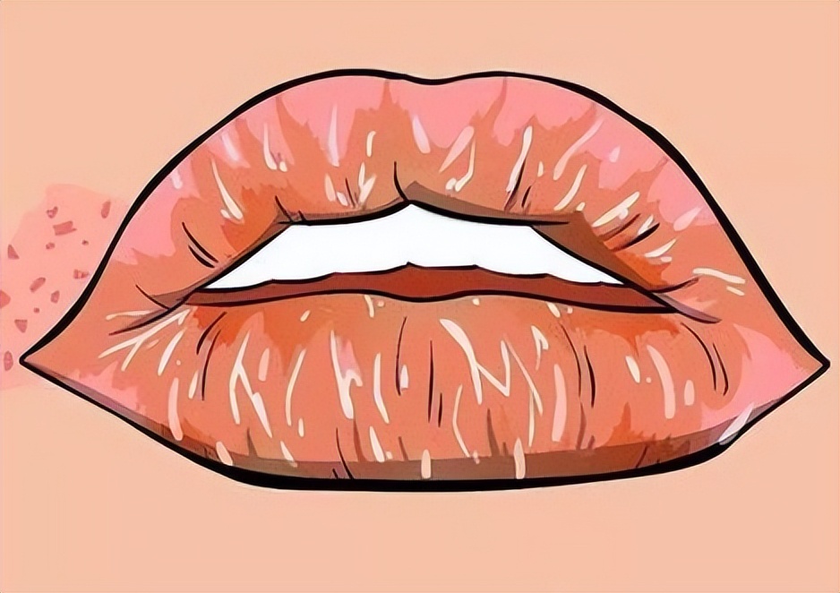 嘴唇干裂、脱皮的女孩看过来！给大家介绍几个护唇妙招