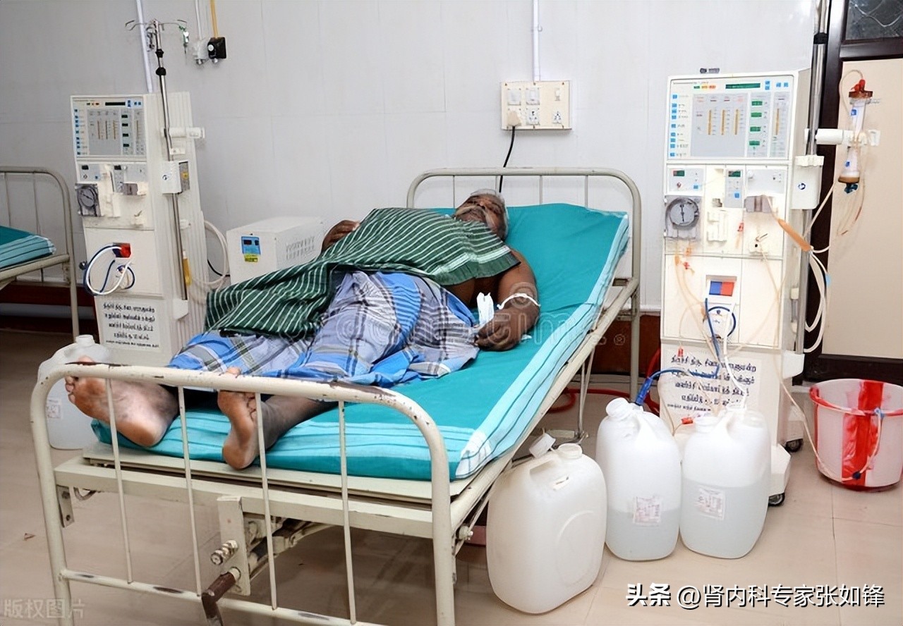 肾病尿毒症能活多久取决于什么,你的肾好不好