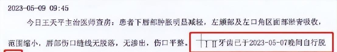 被他人打掉两颗门牙怎么判,被打掉两颗门牙应该怎么处理
