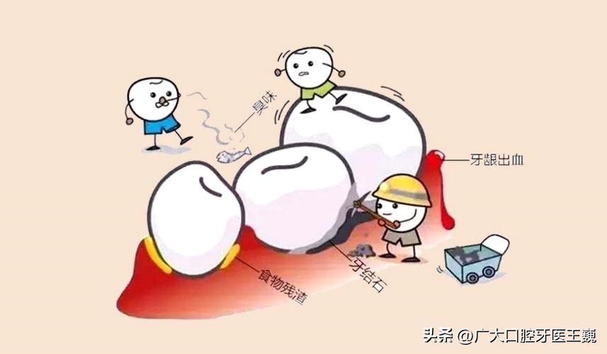 牙龈出血是什么原因牙龈大量出血,牙龈出血的原因和治疗方法是什么