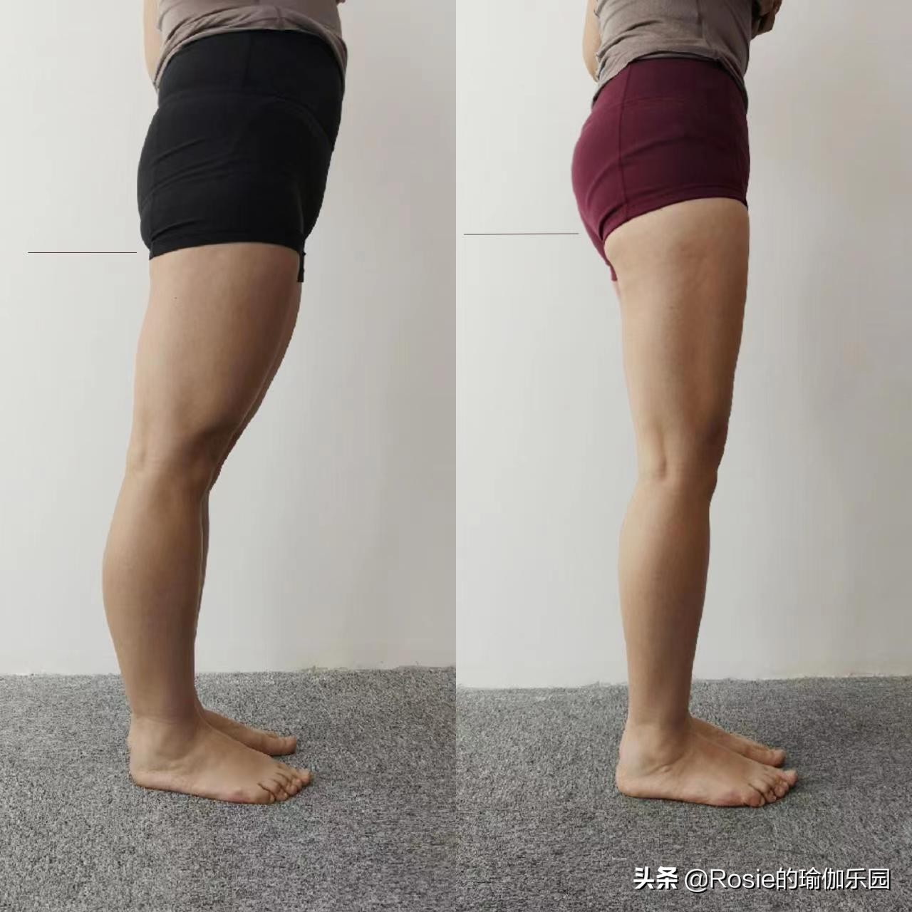 脚踝粗有办法瘦吗,脚踝很细大腿很粗怎么瘦