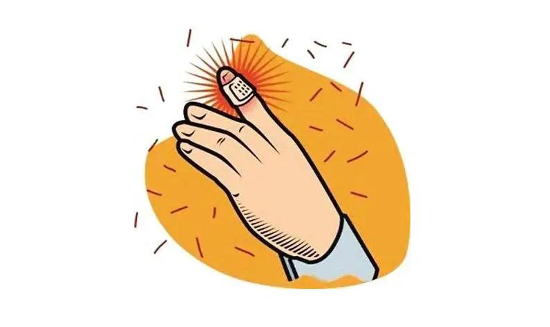 小伤口特别疼要怎么办,小伤口别大意