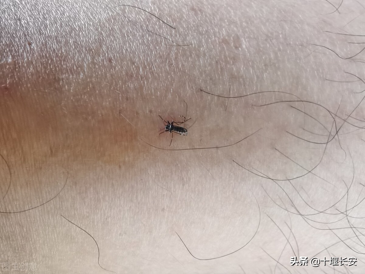 蚊子叮的包越大说明毒性越强吗,蚊子包最好有什么办法处理