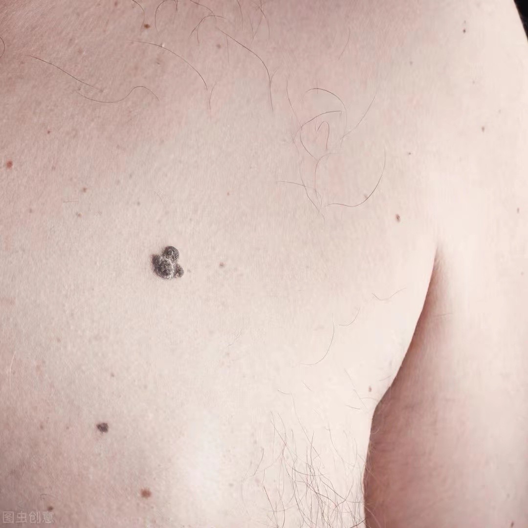 38岁脚底长瘤,脚脖子长疙瘩会有哪些恶性肿瘤