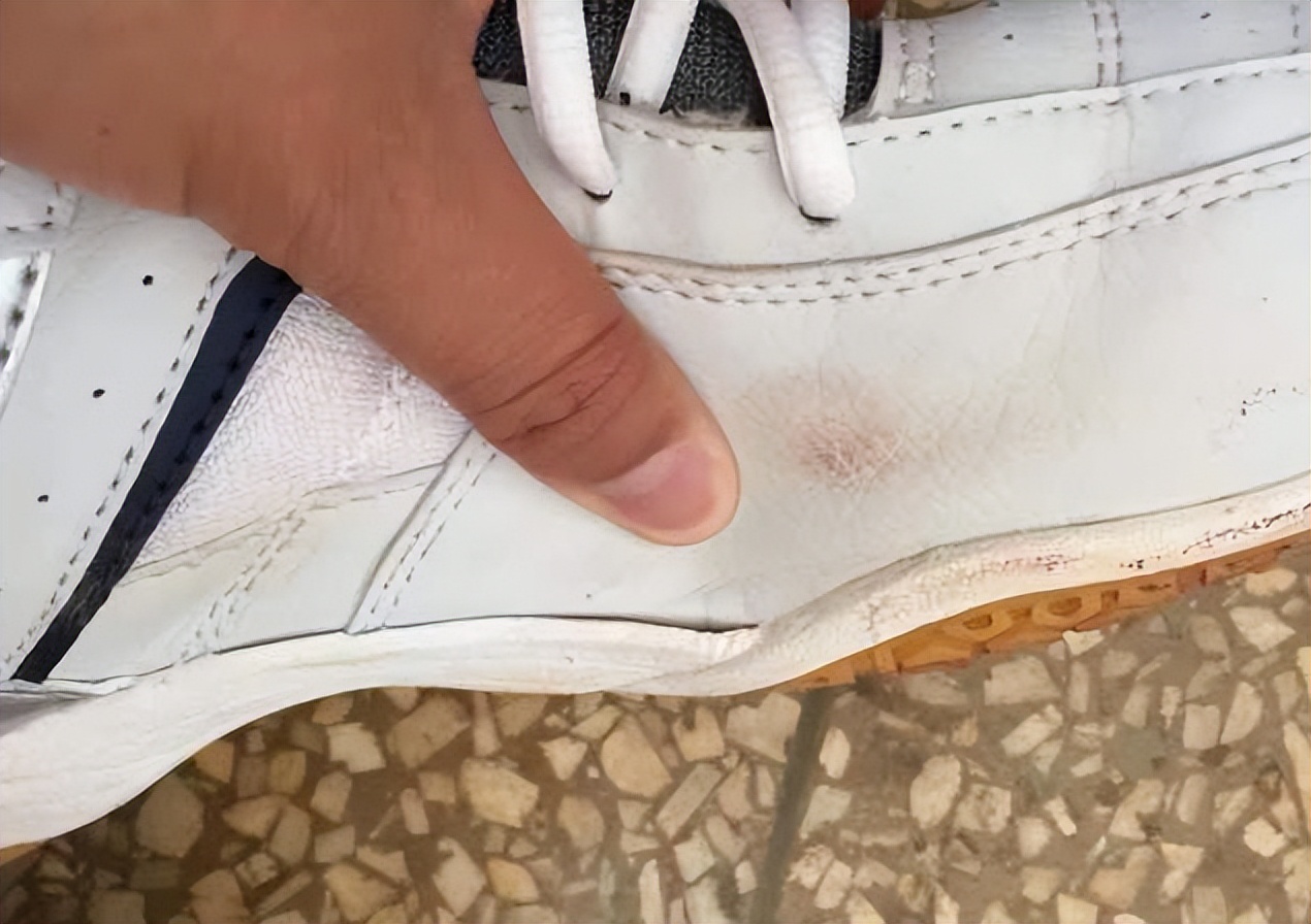 如何正确使用502胶水粘鞋,鞋子开胶用502