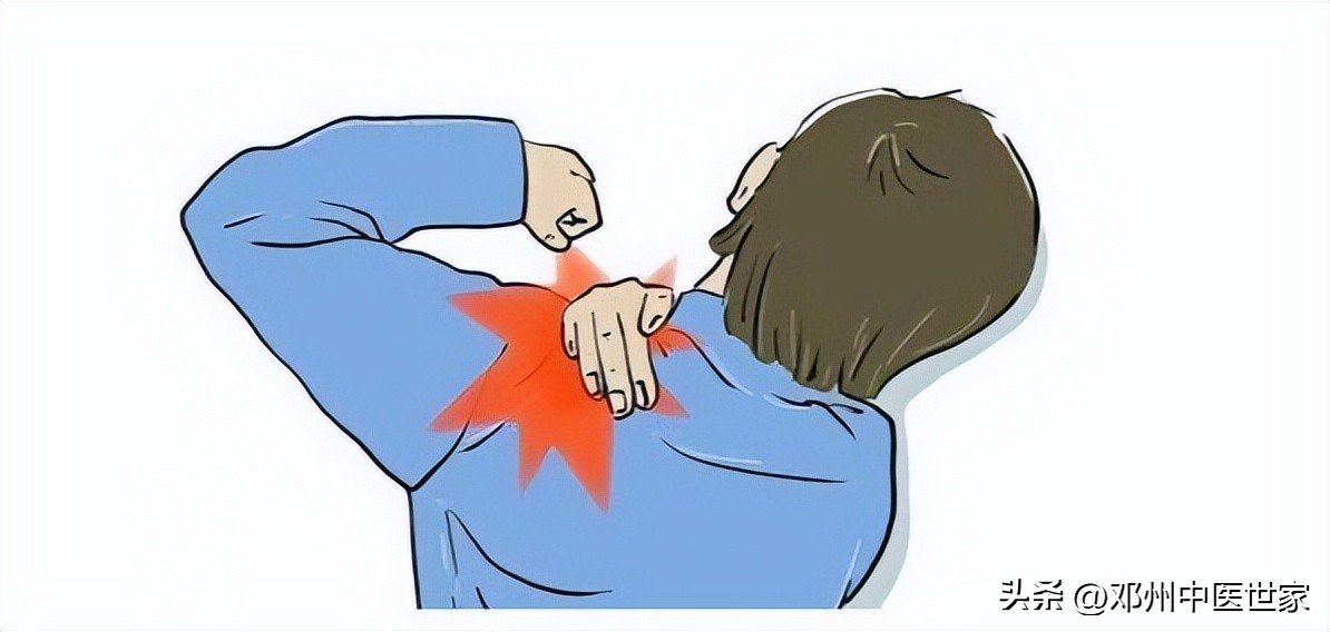 肩周炎治疗病历,肩周炎五十肩