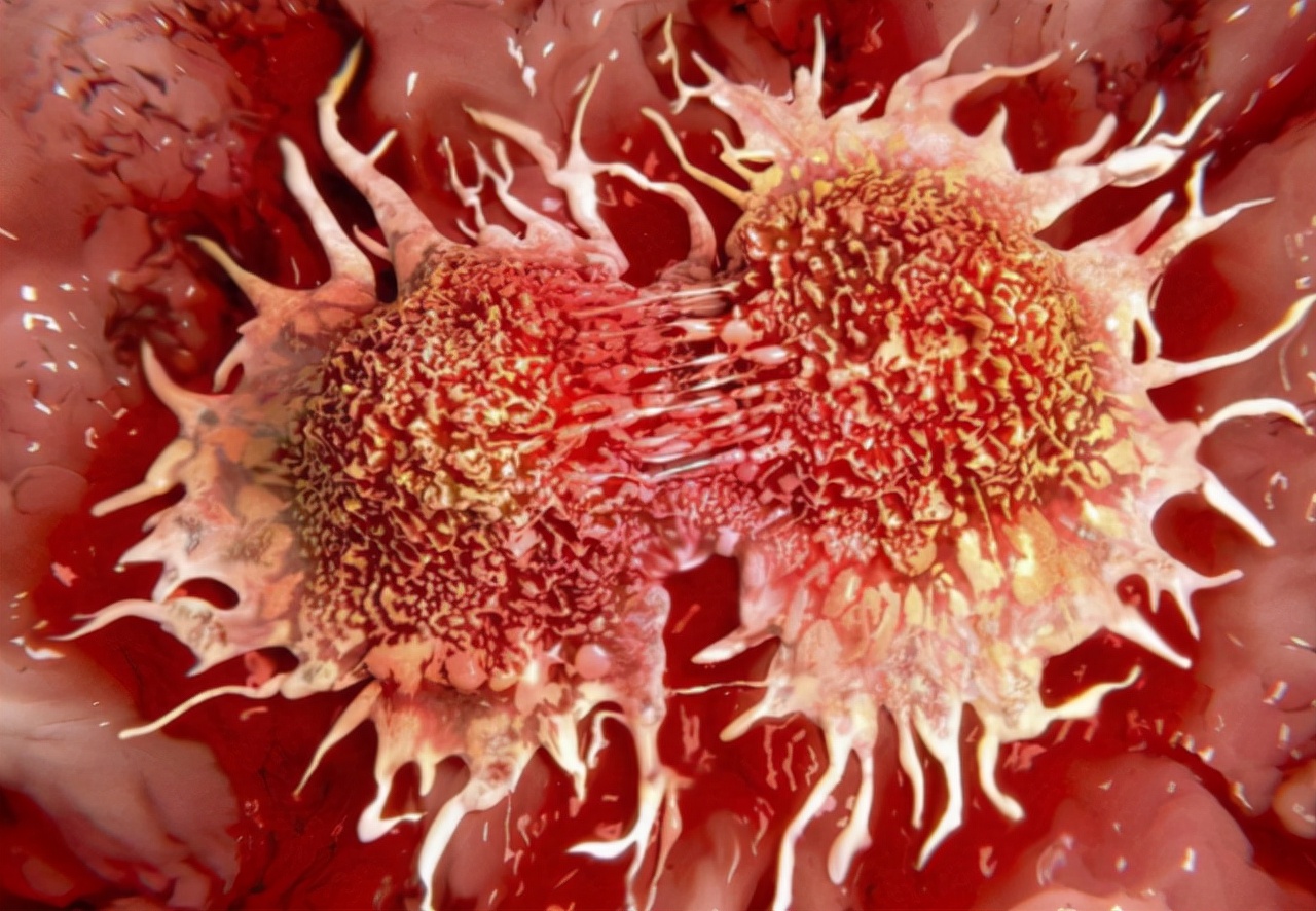 美国青蒿素16小时消灭癌细胞,青蒿素几乎对所有的癌症起作用