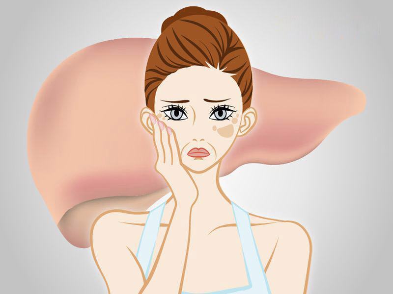 皮下瘀血后留下的黑斑怎么消除,很多年的瘀血黑斑还能去除吗