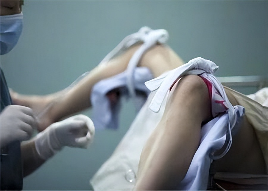 女性做完人流的特征,做完人流的女人有什么症状