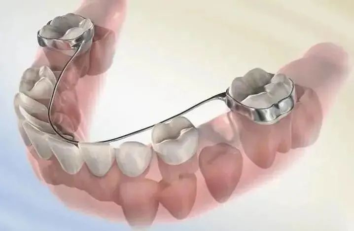 小孩换完牙牙齿长歪能戴牙套吗,孩子换了八颗牙可否矫正