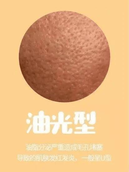 毛孔粗大黑头多脸爱出油怎么解决,解决男士毛孔粗大最简单方法