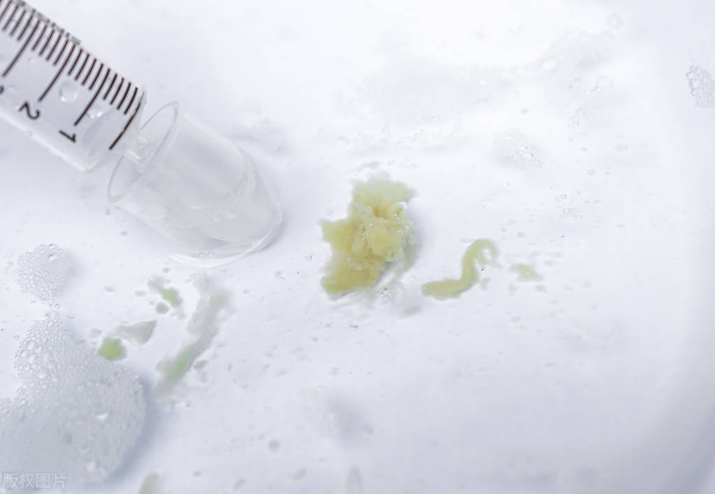 肺部有痰什么药治疗,肺部有痰液通过ct拍出来是什么