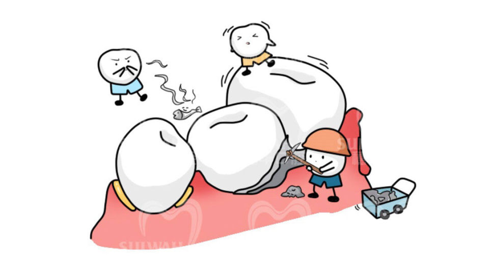 一张嘴就一股臭味是怎么回事,消除口气异味