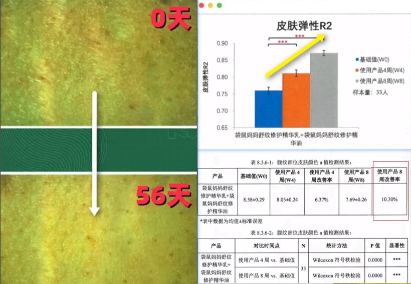 妊娠油有什么坏处,妊娠油有必要用嘛