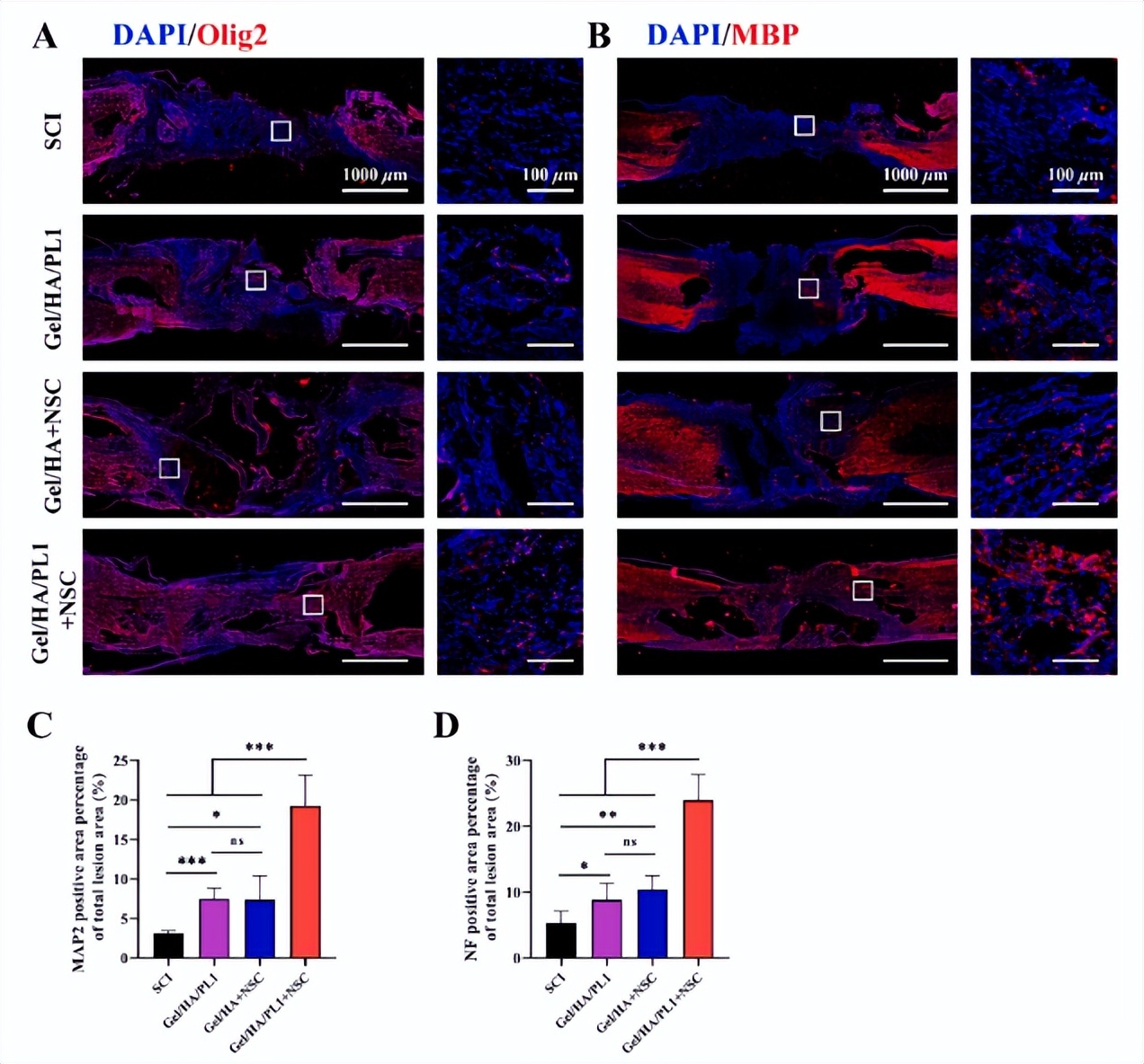 3D打印导电神经支架为脊髓损伤修复提供新策略|科技导报