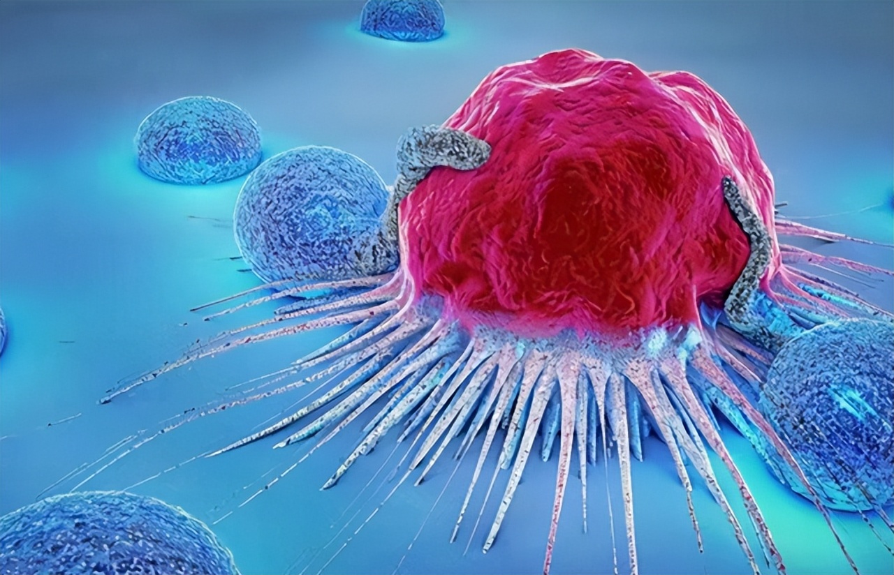 从炎症到癌症多长时间,炎症发展成癌症需要多久