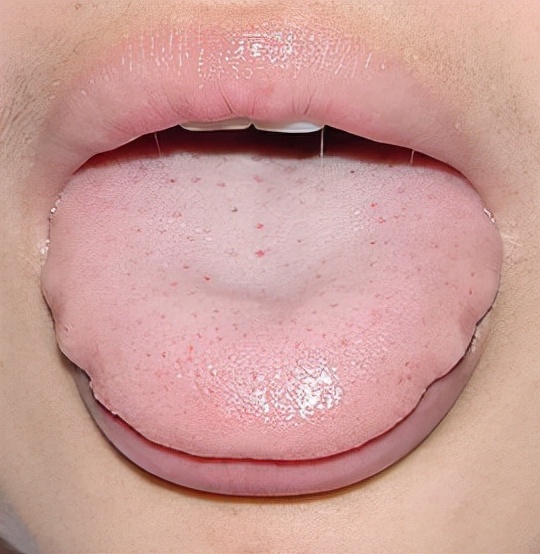 乳腺结节1厘米能消失吗怎么治疗,一年乳腺结节长了1.4厘米