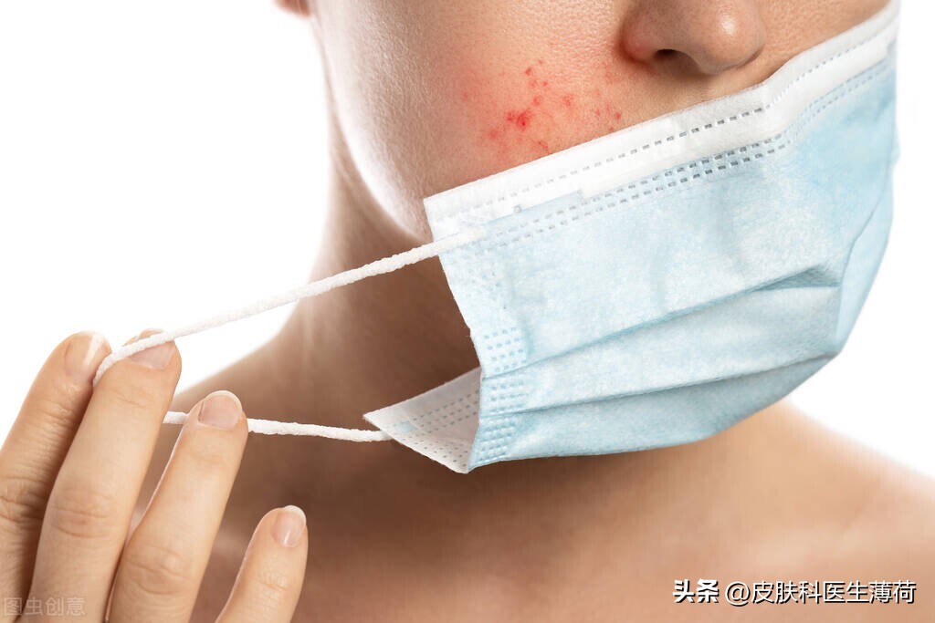 皮肤反复敏感发红长痘怎么办,戴口罩过敏长痘有什么好办法
