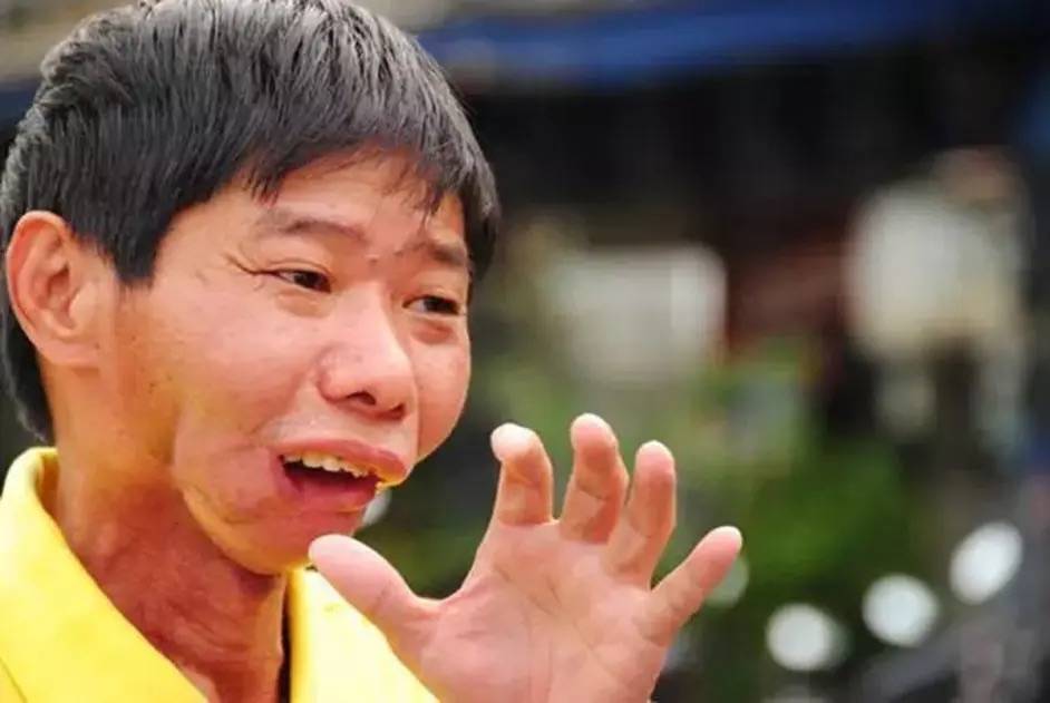 一级致癌物槟榔的危害有多大,5分钟带你了解一级致癌物槟榔