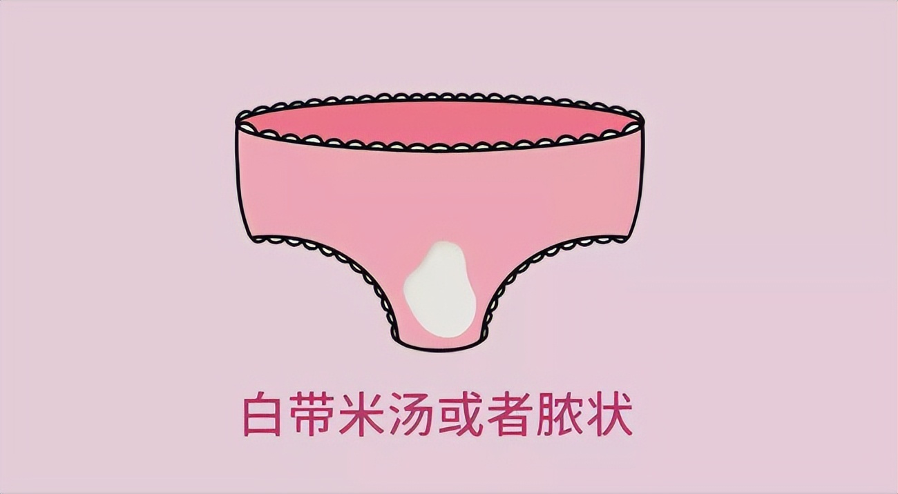 女人没有白带，身体会出现什么变化？医生：这些病症或不请自来