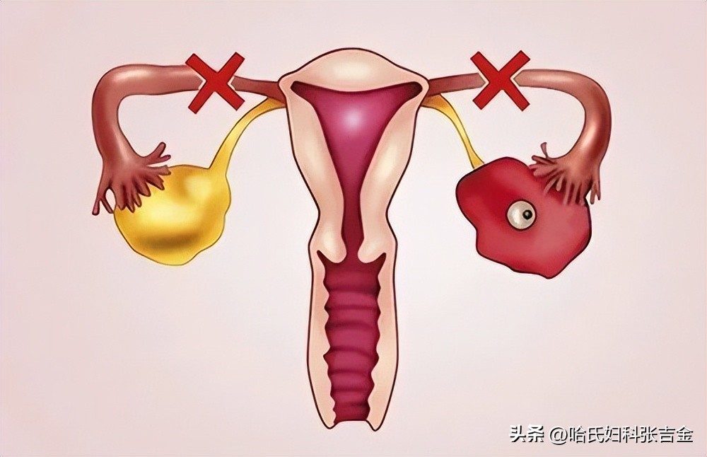 才40岁月经越来越少是什么原因,40卵巢早衰怎么办