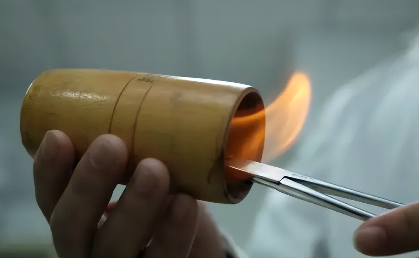 拔火罐吸出来的瘀血是毒素吗,拔完火罐后背上吸出来的瘀血