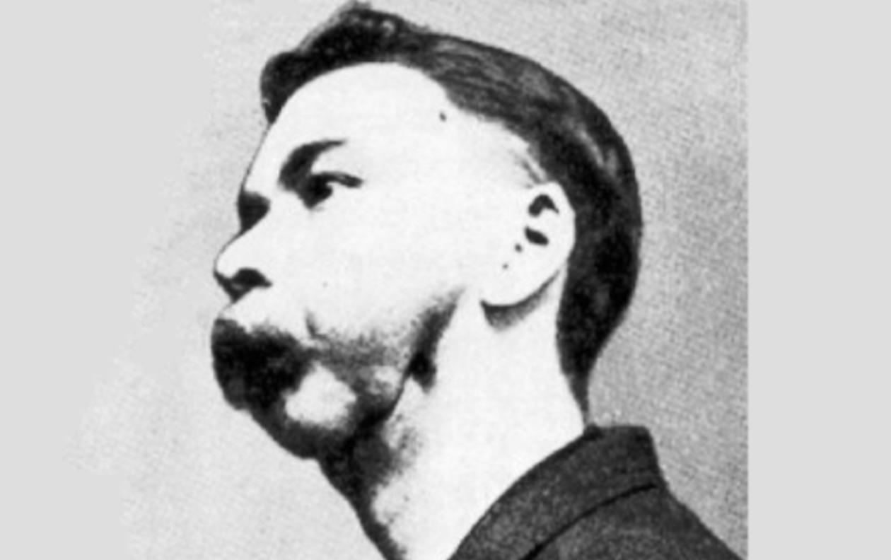 百年前的镭女孩：为制造夜光手表，她们下颌骨被射线残忍摧残