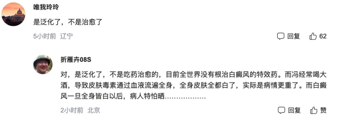 冯小刚白癜风多长时间治愈的,冯小刚的白癜风为什么治不好