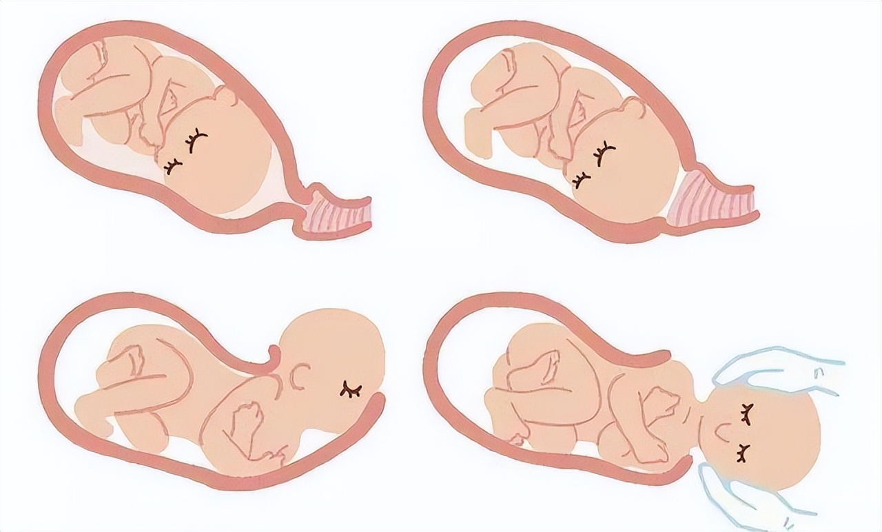 阴道松弛有哪些症状要怎么办,阴道松弛的症状和危害