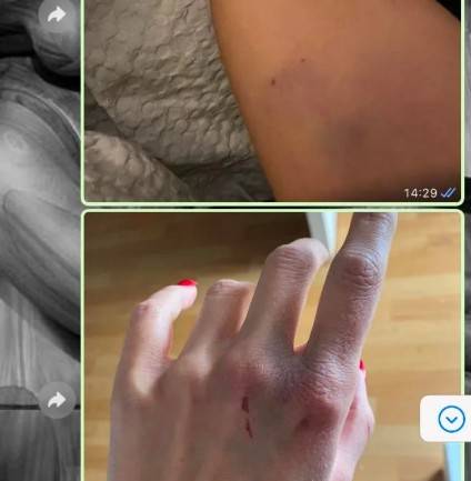 德国前国脚舒尔茨涉嫌家暴,德国前国脚舒尔茨涉嫌严重家暴