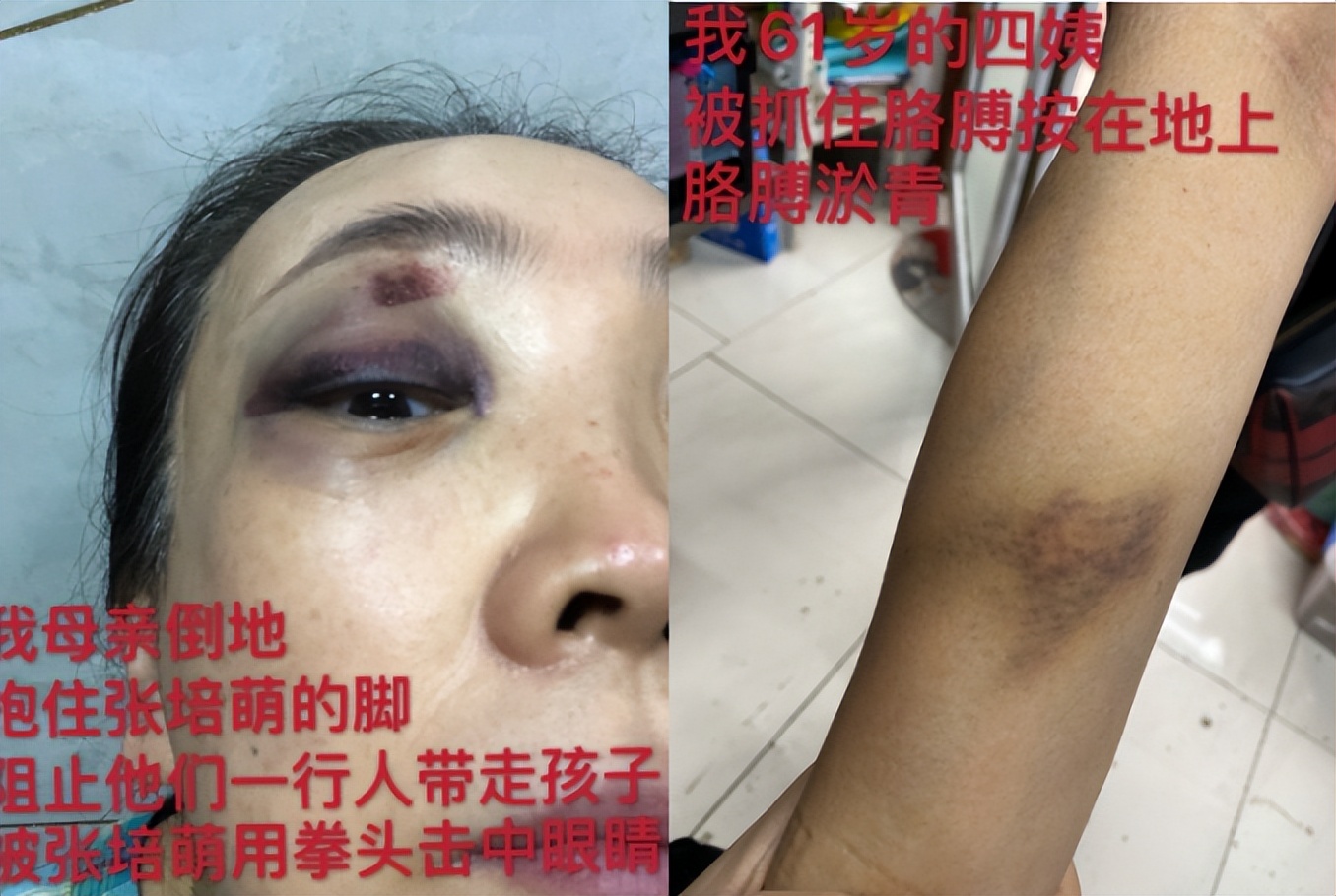 有家暴的运动员,有成绩没人品