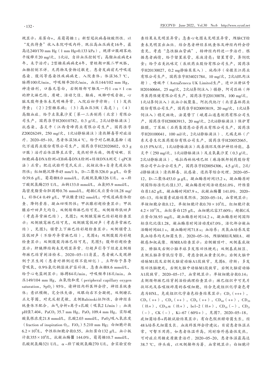 伴神经系统受损的组织细胞坏死性淋巴结炎一例报道并文献复习