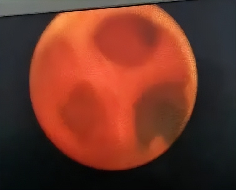 河北省中医院男科专家门诊表,河北省人民医院泌尿外科怎样