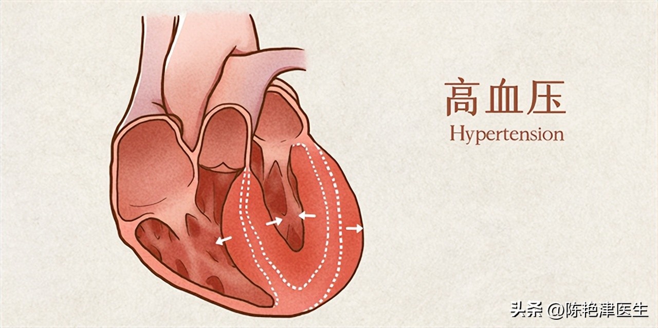 一饿就心慌头晕手抖是低血糖吗,一饿就低血糖心慌手抖怎么治疗