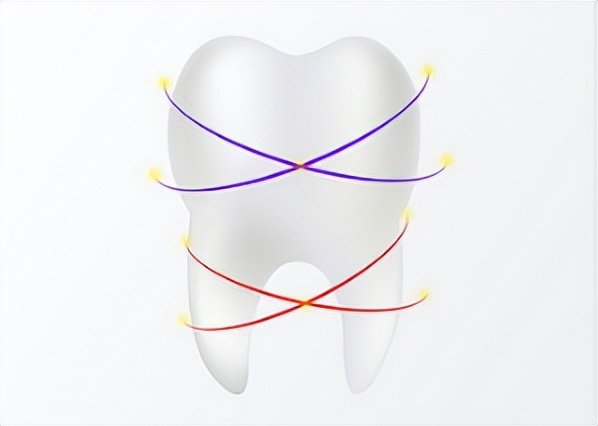 北京圣贝口腔矫正牙齿怎么样,北京圣贝口腔正畸案例