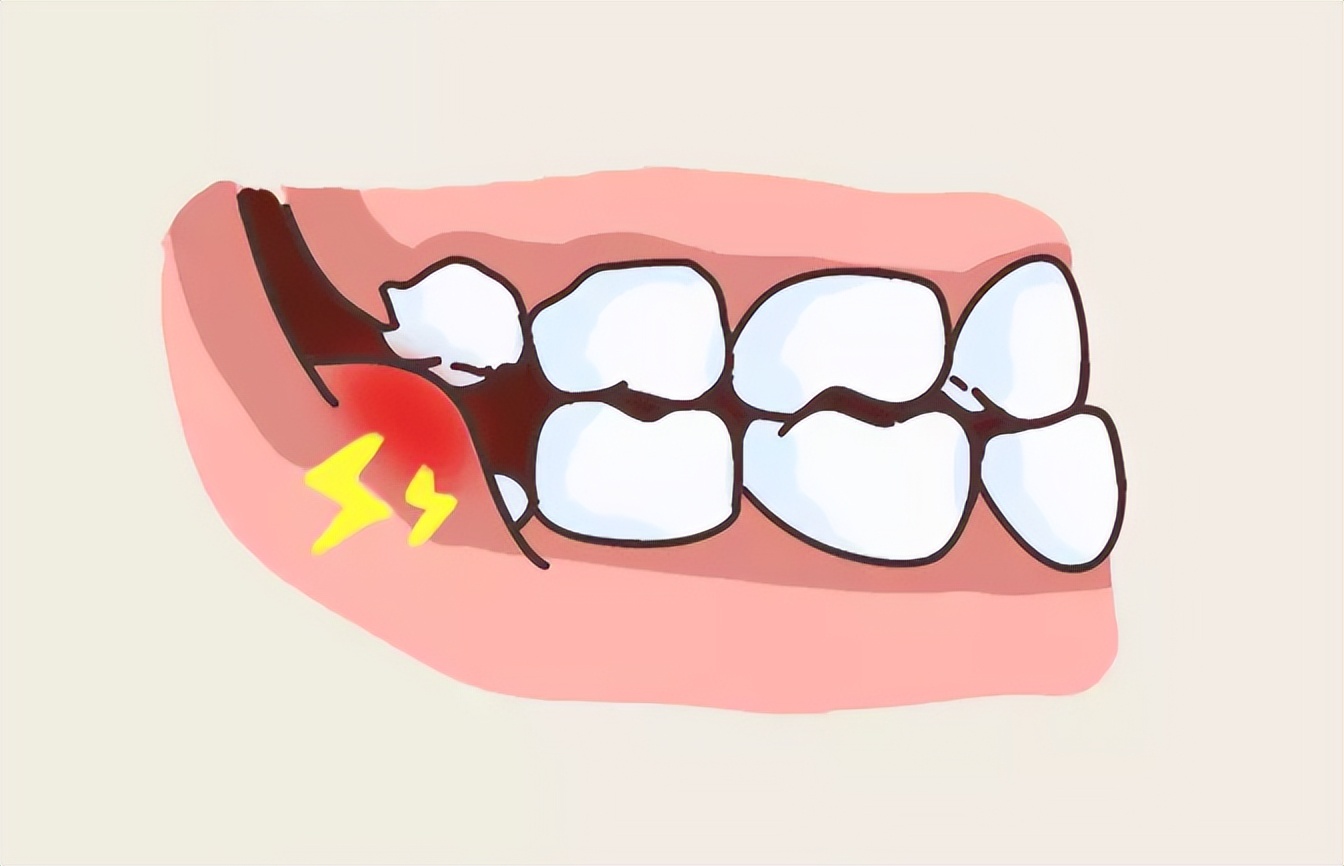牙疼得要命会自愈吗,牙疼硬抗多久能把牙神经扛过去