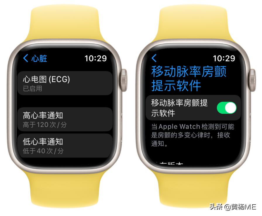 applewatch最实用的小功能,applewatch一些实用的功能