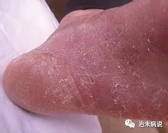 小米天天吃会长胖吗,小米天天吃有营养