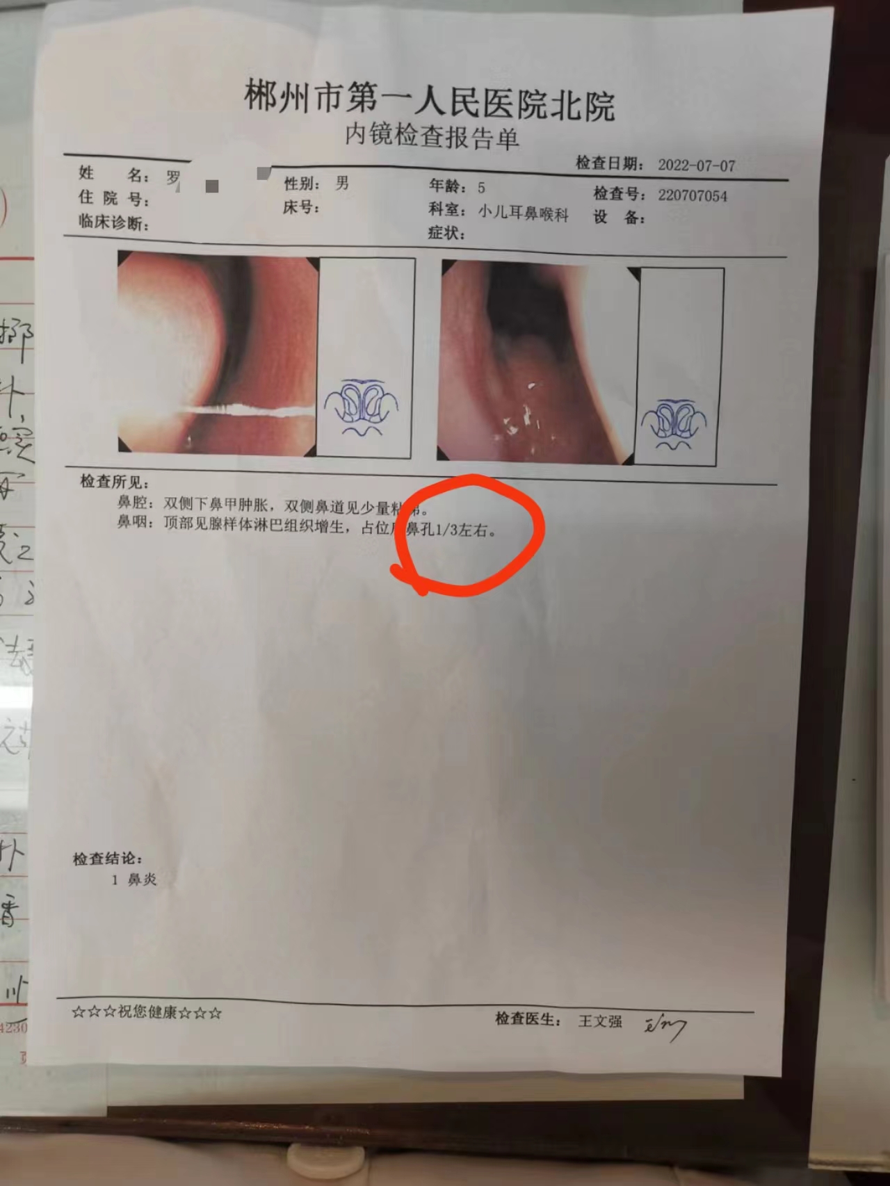 小儿腺样体肥大中医怎么治,中医治疗腺样体肥大的名医