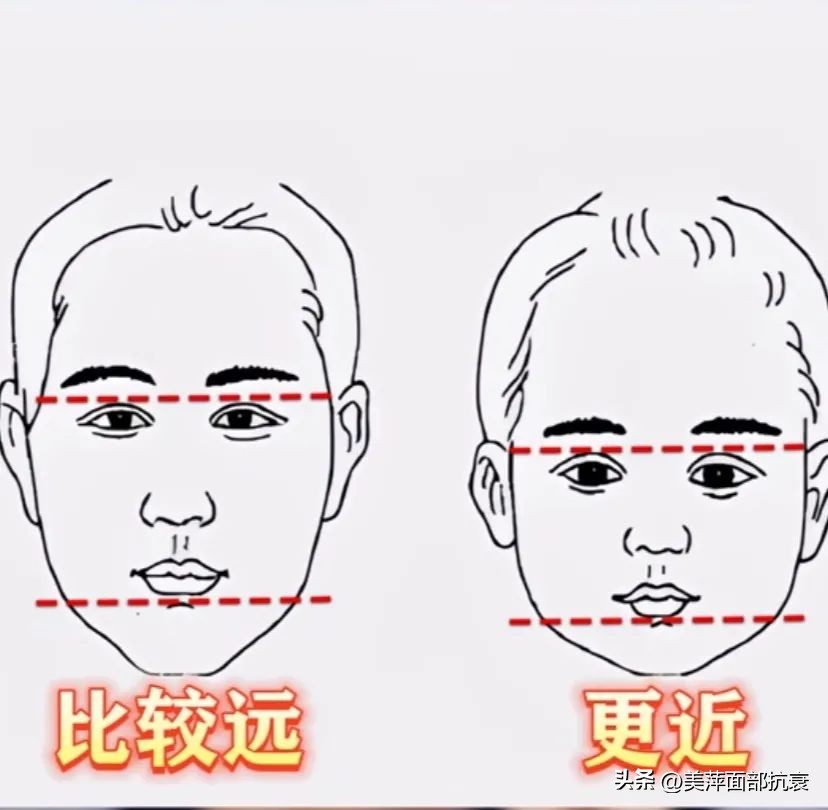 中庭长怎么避免显老,中庭长怎么改善