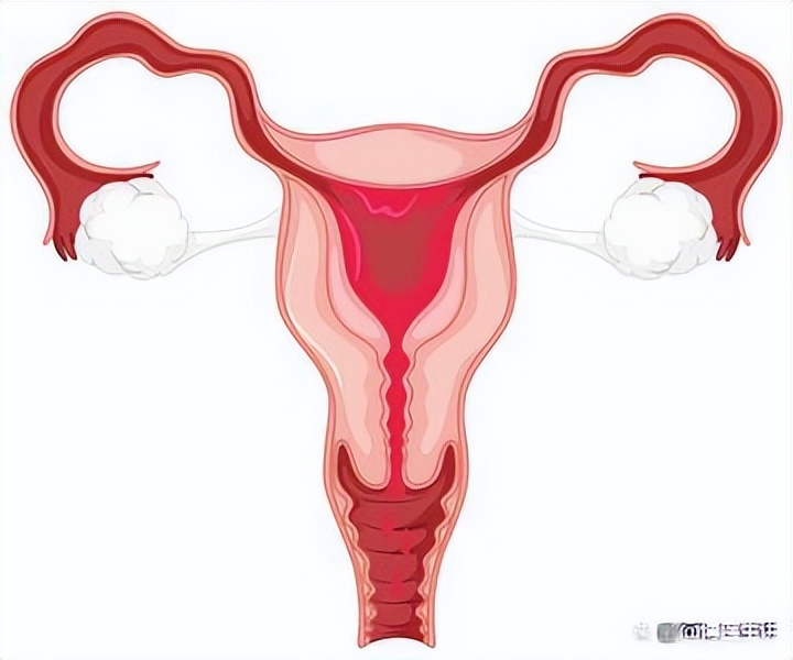 子宫有炎症的女人，身体或出现“2痛1多”，别硬撑到宫颈癌