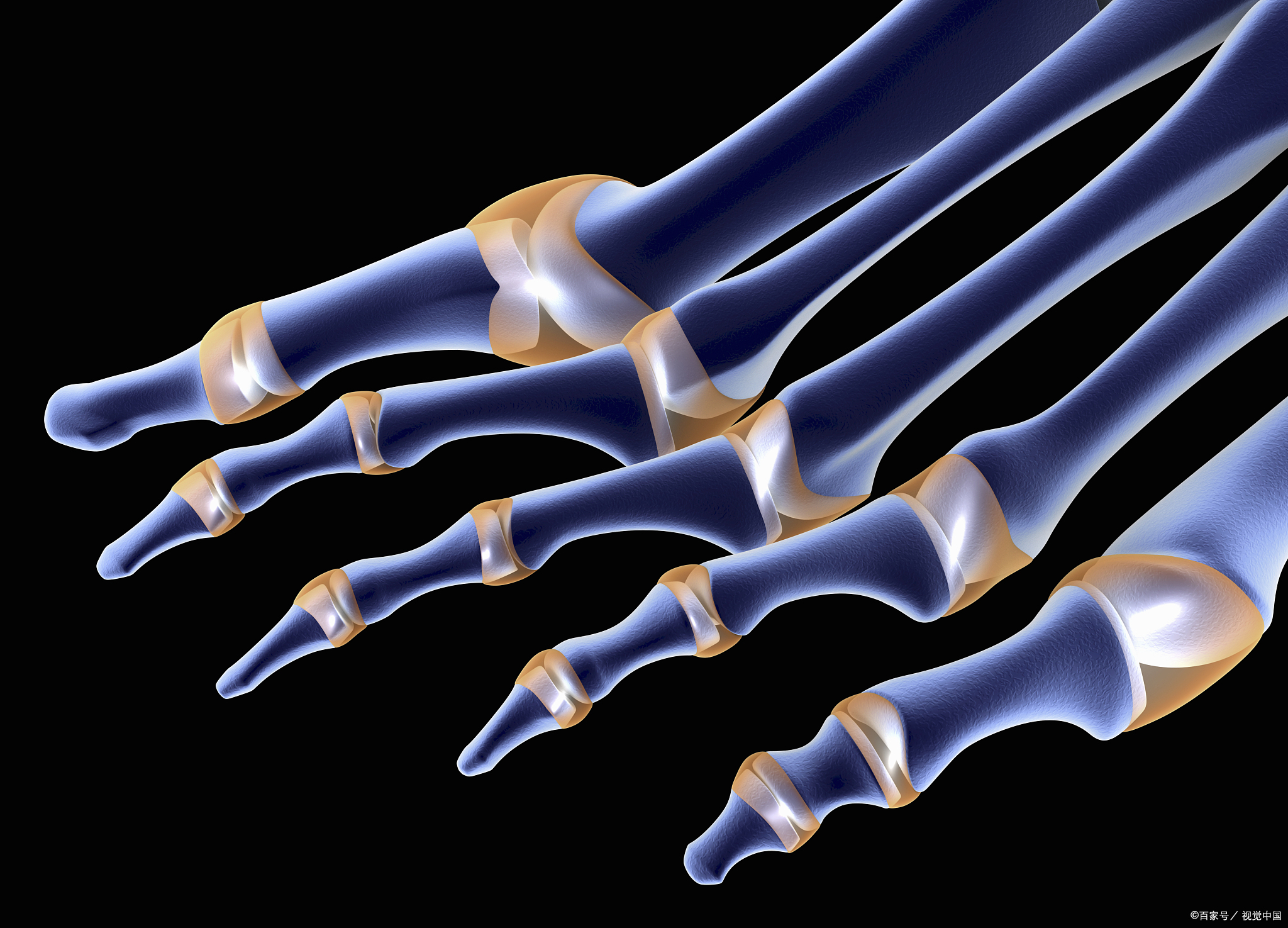 骨头关节有响声是什么原因,锻炼时关节发出响声是怎么回事