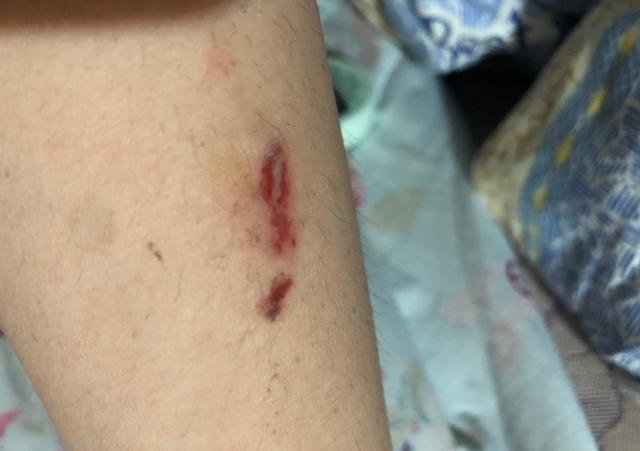 能增强自己免疫力的吃食有什么,提高免疫力可以吃什么零食