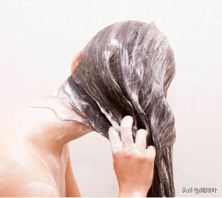 头油头痒头屑掉头发怎么治疗,头屑多头皮痒油头有什么好妙招