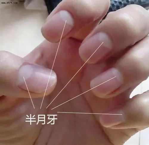 指甲上月牙越多身体越健康吗,指甲上月牙越多代表越健康