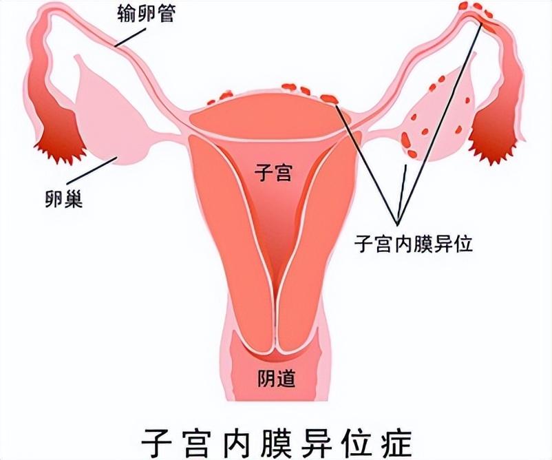 姨妈过后外阴疼是怎么回事,女士下身隐隐疼怎么回事