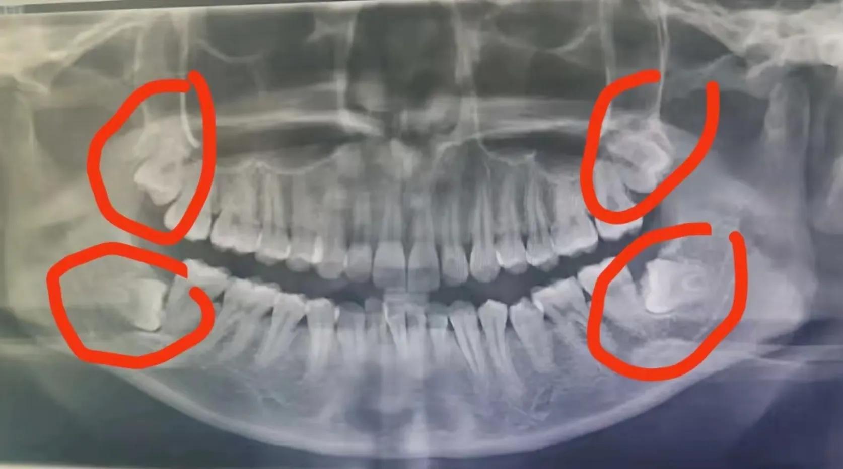 牙齿历险记视频大全,牙齿历险记完整版